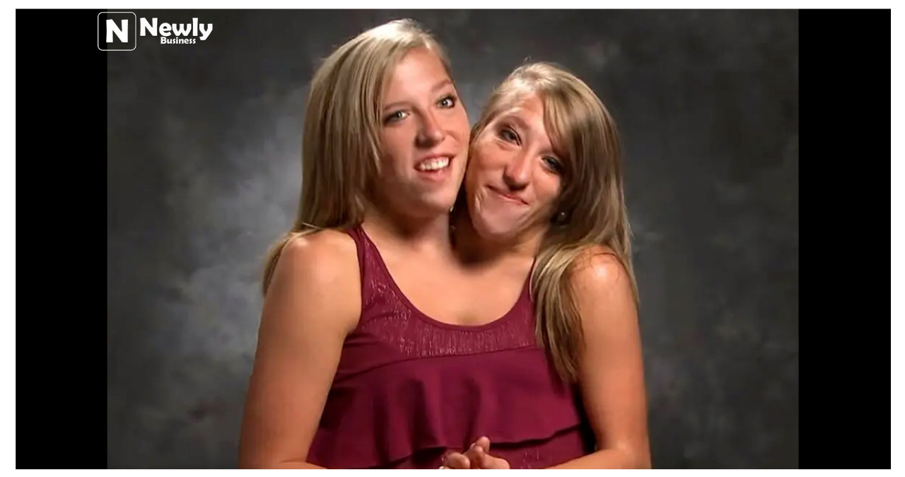 The Extraordinary Journey of the Hensel Twins